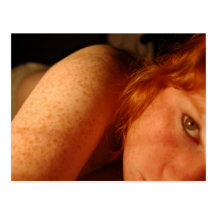 Freckles Cartao Postal