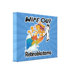 Limpe para fora Retinoblastoma Impressão Em Canvas