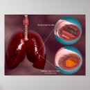 Pesquisar por traqueia pósteres Sistema respiratório