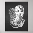 Pesquisar por gravidez pósteres Para ela