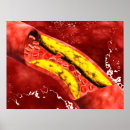 Pesquisar por chapa pósteres Ilustração