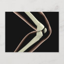 Pesquisar por ossos humanos cartoes postais Patella