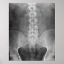 Pesquisar por xray pôsteres pósteres Médico