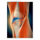 Pesquisar por inflamação cartoes postais Médica