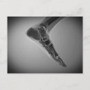 Pesquisar por ossos do pé cartoes postais Anatomia humana