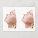 Pesquisar por inflamação cartoes postais Close up