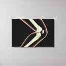 Pesquisar por joelho impressão de canvas Membros humanos