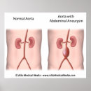 Pesquisar por abdômen pôsteres pósteres Médico