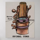 Pesquisar por nervo pósteres Espinal