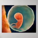 Pesquisar por feto pôsteres pósteres Saco amniotic