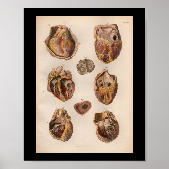 1879 Vintage Bock Anatomy Impressão Heart Muscles (Frente)