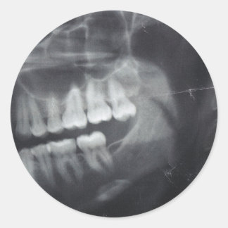 Adesivo Jaw Stickers