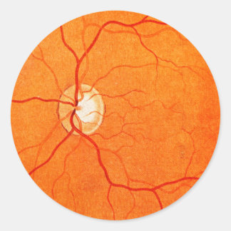 Adesivo Optometria Oftalmológica Vinheta de Exame do Fundu