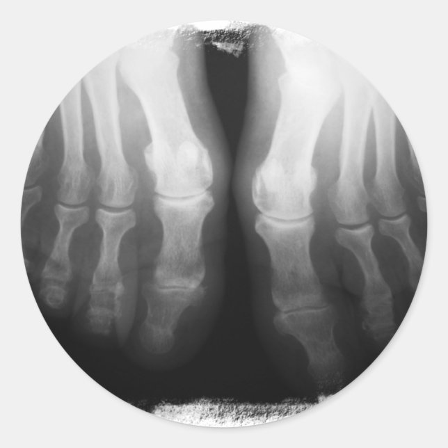Adesivo Preto & branco de esqueleto humanos de ossos dos (Frente)