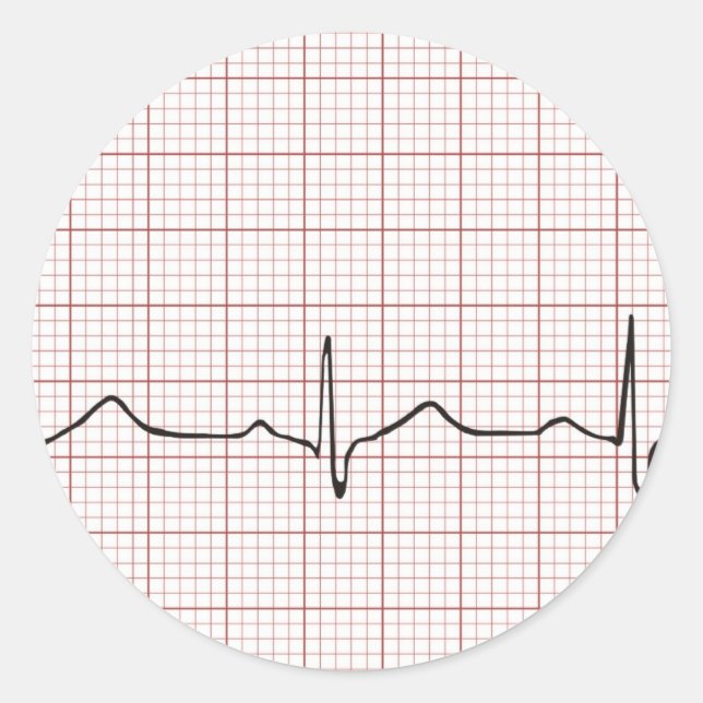 Adesivo Pulso do ECG em papel gráfico, PhD (médico) pulso (Frente)