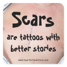As cicatrizes são tatuagens com uma história melho
