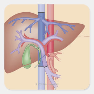 Adesivo Quadrado Procedimento de transplante hepático