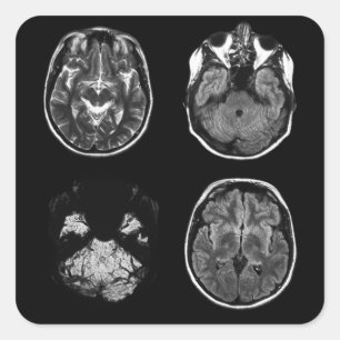 Adesivo Quadrado Varredura por ressonância magnética do cérebro
