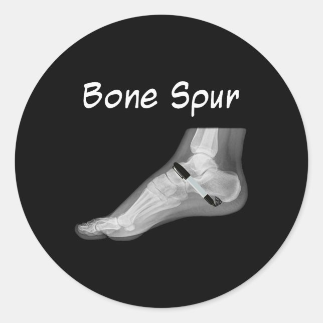 Adesivo Trump Bone Spur Ink Pen Funny Anti Trump  (Frente)