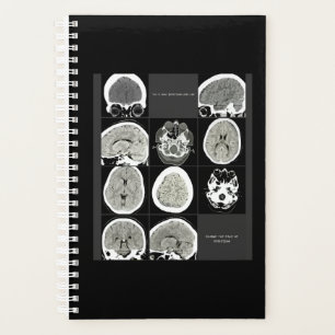 Agenda FullCTScan_this é o tipo de depressão
