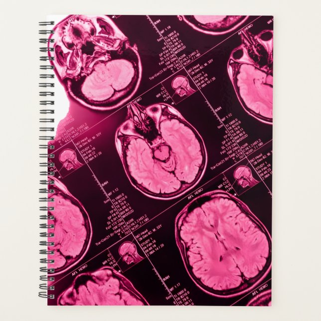Agenda MRI magenta: uma visão axial do cérebro (Frente)