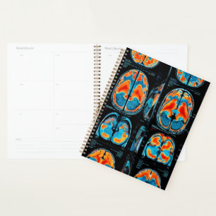Agenda ressonância magnética cerebral