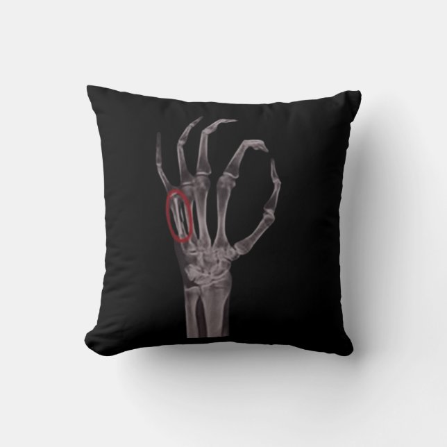 Almofada Mãos quebradas Esqueleto X-RAY T-Shirt (Frente)