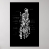 Anatomia do pé Poster médico 24 x 36"