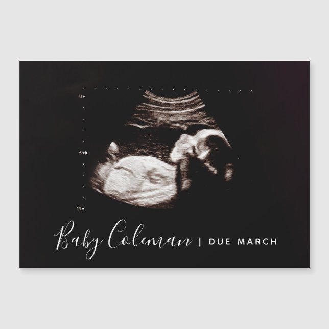 Anunciar Gravidez Nome do Sonograma Magnet (Frente)