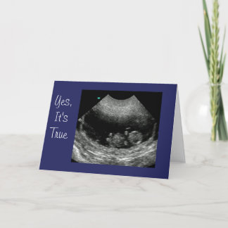 Anúncio Bebê novo Anouncement