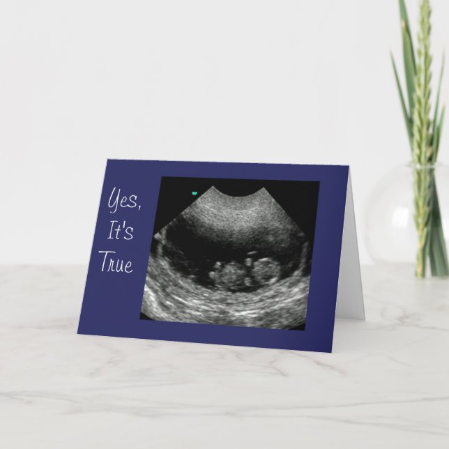 Anúncio Bebê novo Anouncement (Frente)