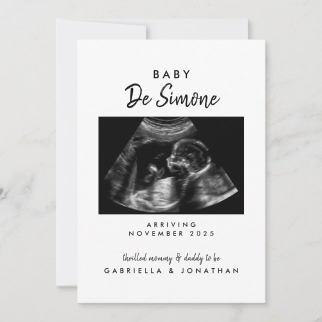 Anúncio  Black White Typography Sonogram Photo Pregnancy (Frente)