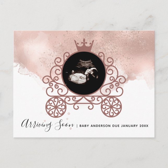 Anúncio de Gravidez da Princesa Sonograma (Frente)