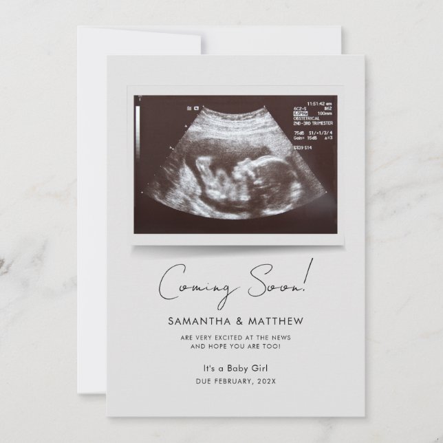 Anúncio Em Breve, Photo Baby Scan Pregnancy (Frente)
