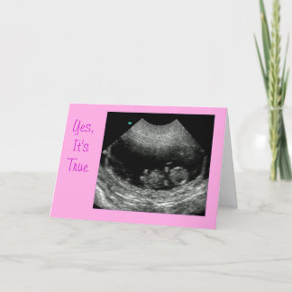 Anúncio Rosa de bebê novo