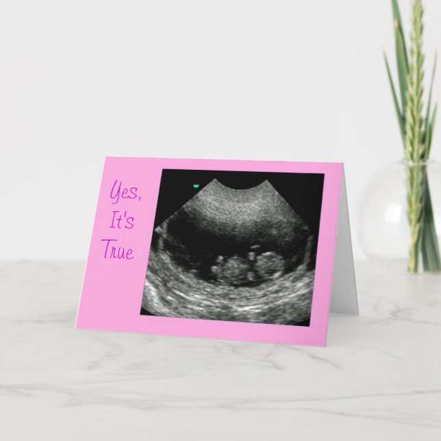 Anúncio Rosa de bebê novo (Frente)