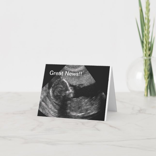 Anúncio Ultra-som novo do bebê (Frente)