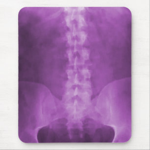 Arte roxa Mousepad do raio X de Digitas