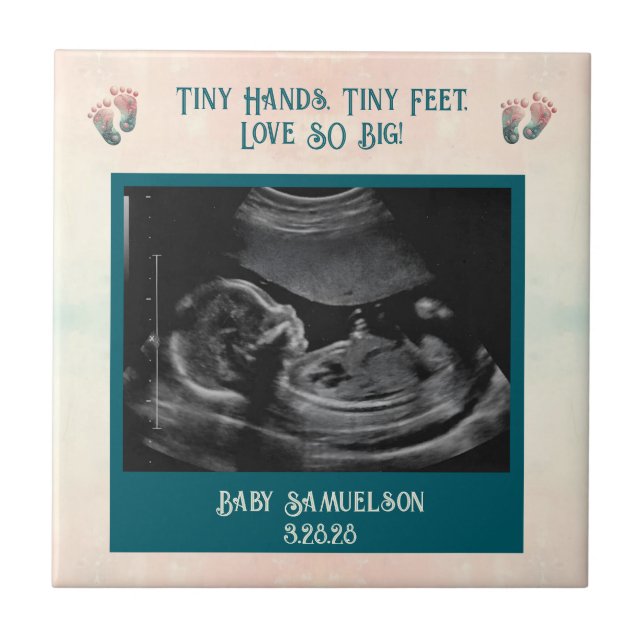 Azulejo De Cerâmica Caixa de Presente do Baby Ultrassom Keepsasaame (Frente)