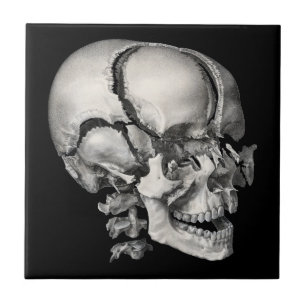 Azulejo De Cerâmica Ciência Vintage Anatomia Humana, Crânio Antigo