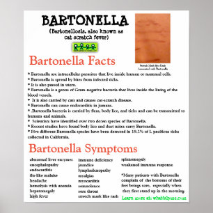 Bartonella Information Fact Poster