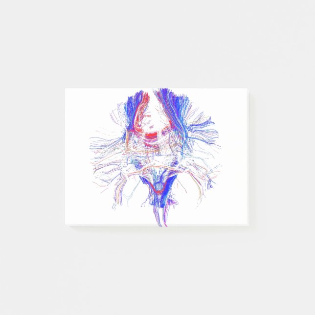 Bloco De Notas Cérebro e Tracktography (Frente)