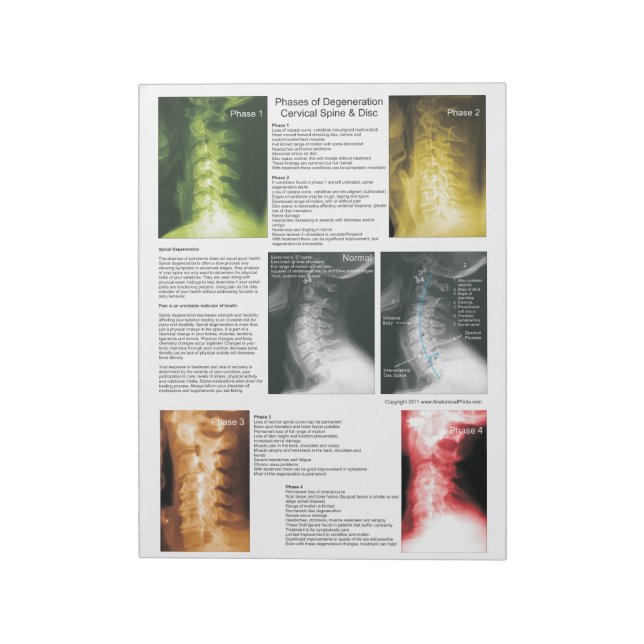 Bloco De Notas Derramamento Da Derramação Cervical Spinal (Invertido)