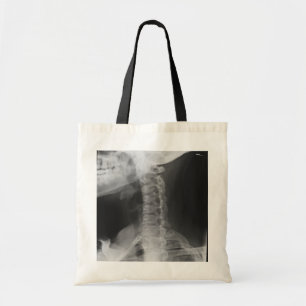Bolsa Tote 2 radiografados