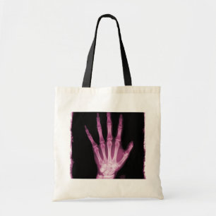 Bolsa Tote Mão cor-de-rosa do esqueleto do raio X