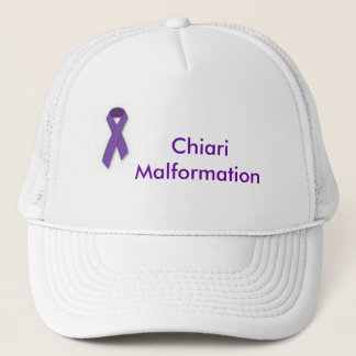 Boné Chapéu da malformação de Chiari