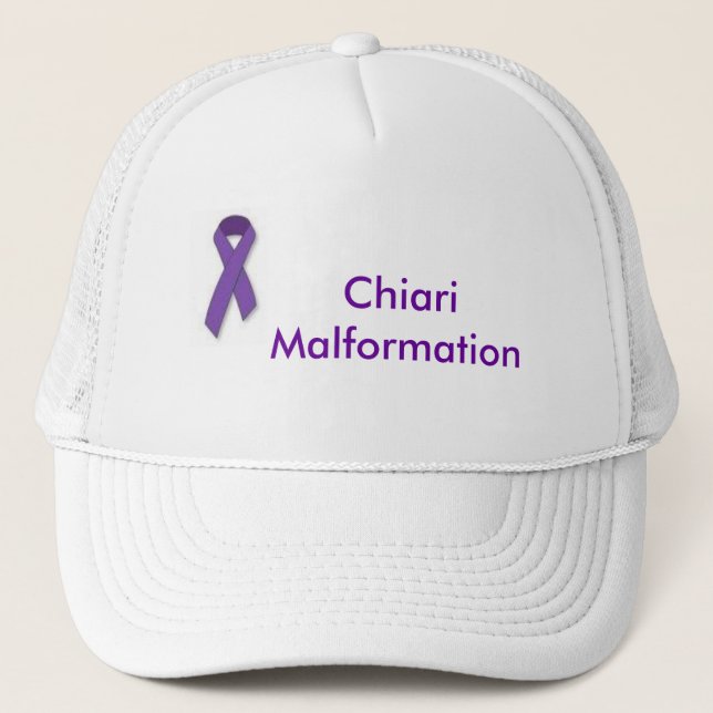 Boné Chapéu da malformação de Chiari (Frente)