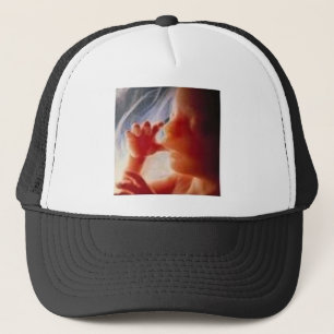 Boné É uma criança ....... não uma escolha!!