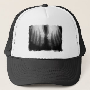 Boné Preto & branco de esqueleto humanos de ossos dos