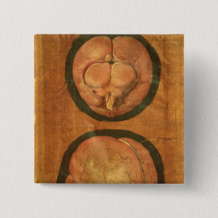 Bóton Quadrado 5.08cm Desenho anatômico do cérebro humano
